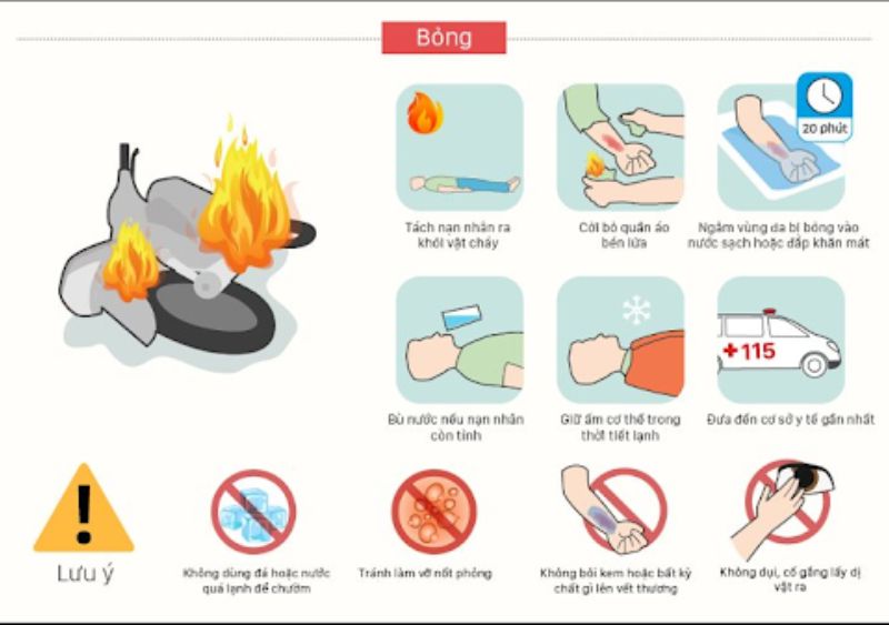 biện pháp sơ cứu người bỏng
